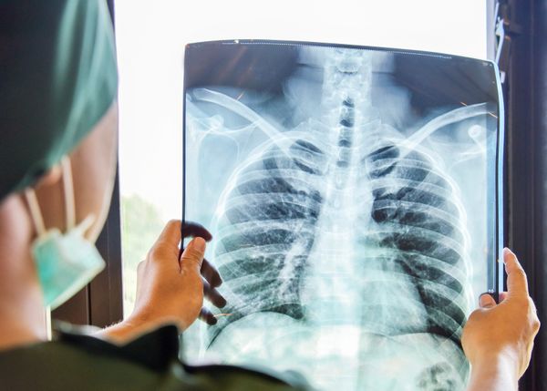 AI innovations set to revolutionise the NHS